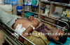 Mangaluru: 2 bikers stab auto driver after a bitter quarrel